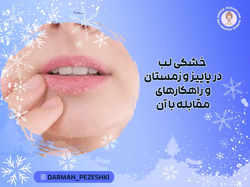 خشکی لب در پاییز و زمستان و راهکارهای مقابله با آن