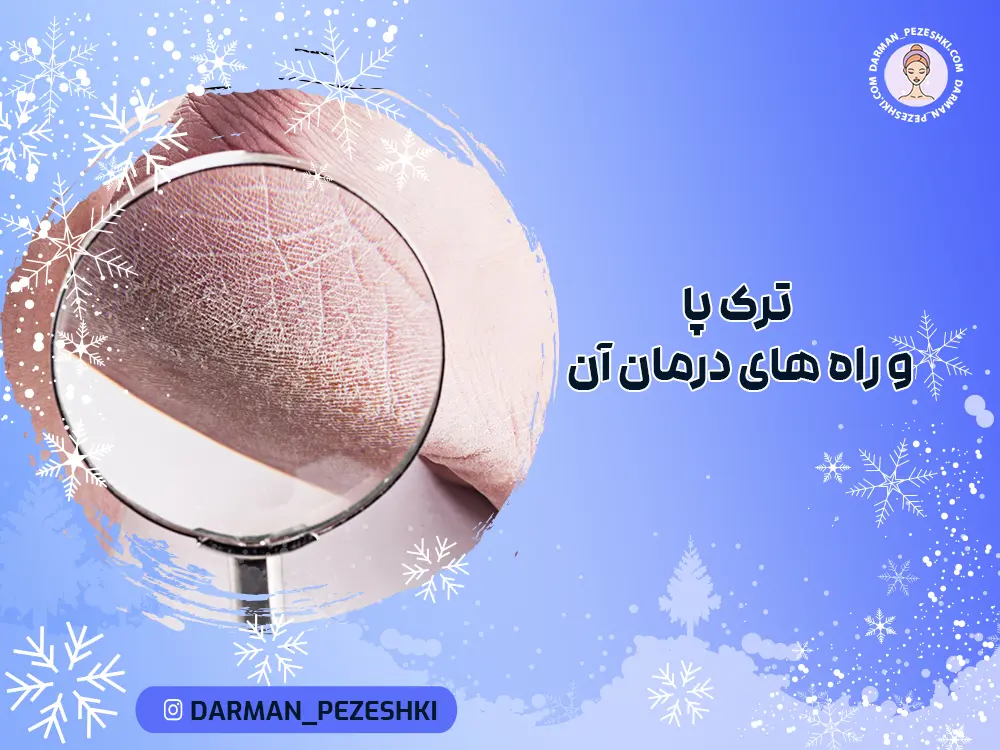 ترک پا و راه های درمان آن