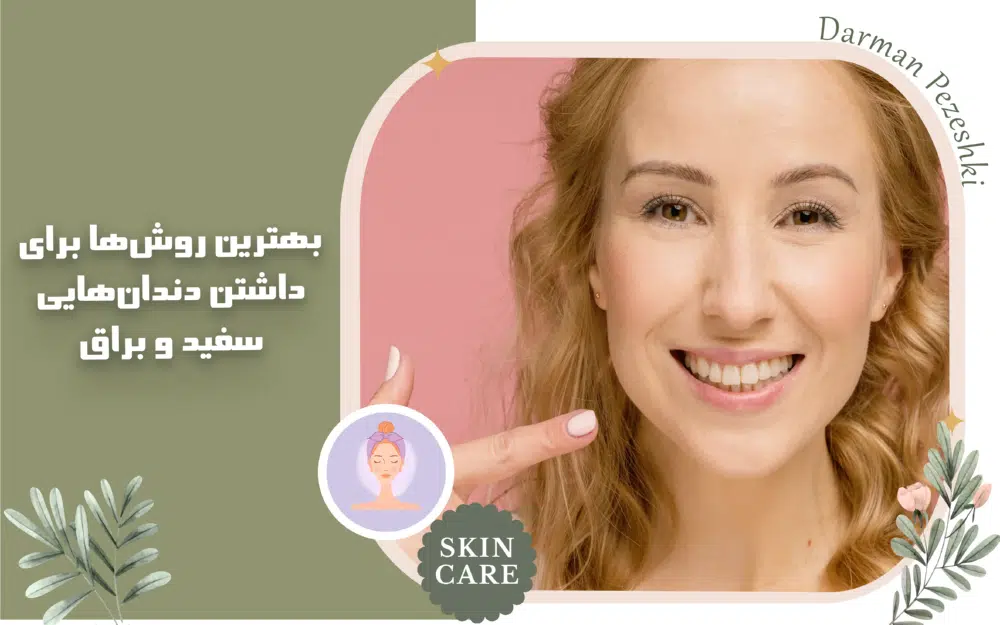 بهترین روشها برای داشتن دندانهایی سفید و براق