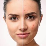 محلول ضد جوش و التیام بخش آزلین 40 آردن سبوما - تصویر 3